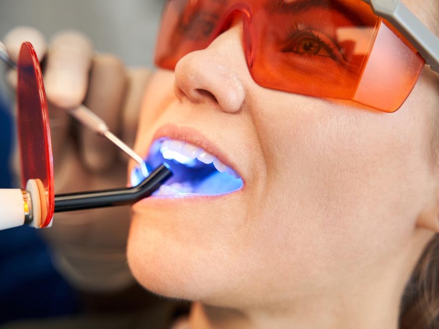 ПРЯМЫЕ РЕСТАВРАЦИИ