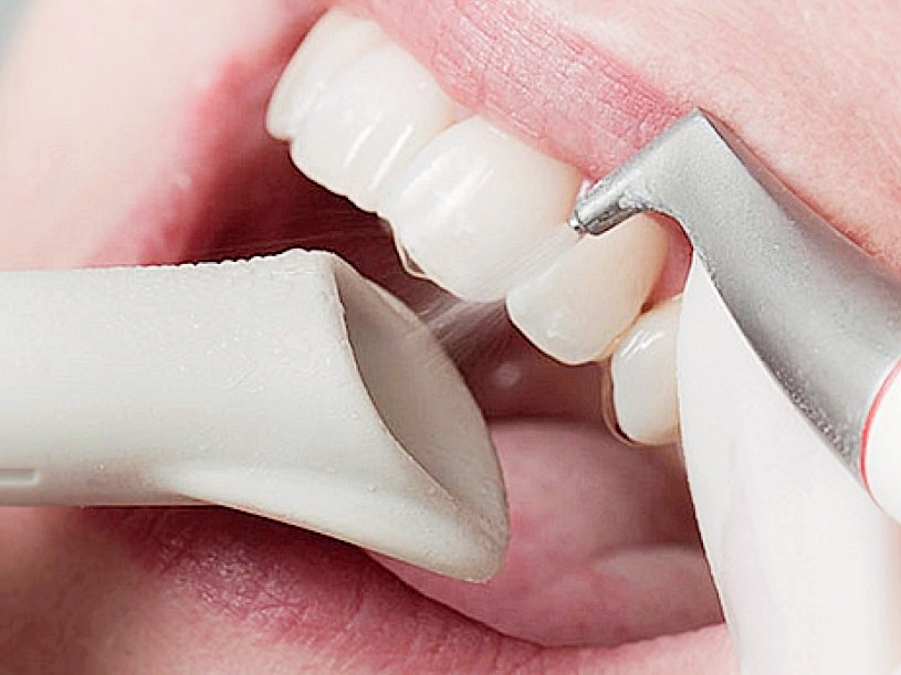 ГИГИЕНА ПОЛОСТИ РТА