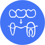 Коронки и мосты