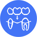 Мостовидные конструкции