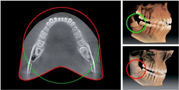 Компьютерная томография в стоматологии СтомартСтудио Леонардо
