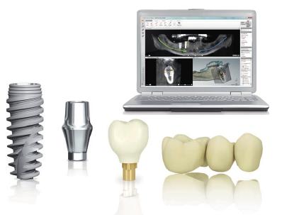 Преимущества зубных имплантов Nobel Biocare