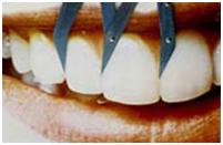 Золотое сечение в стоматологии
