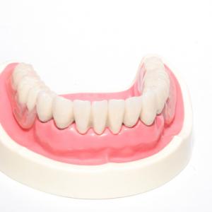 протезирование зубов съемными протезами фото